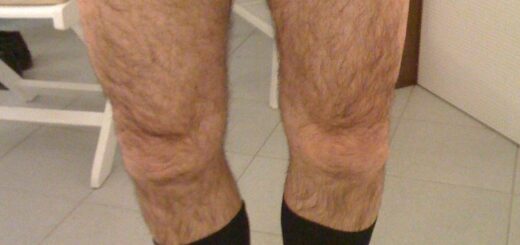 Genoux avant traitement avec la Reboutologie®